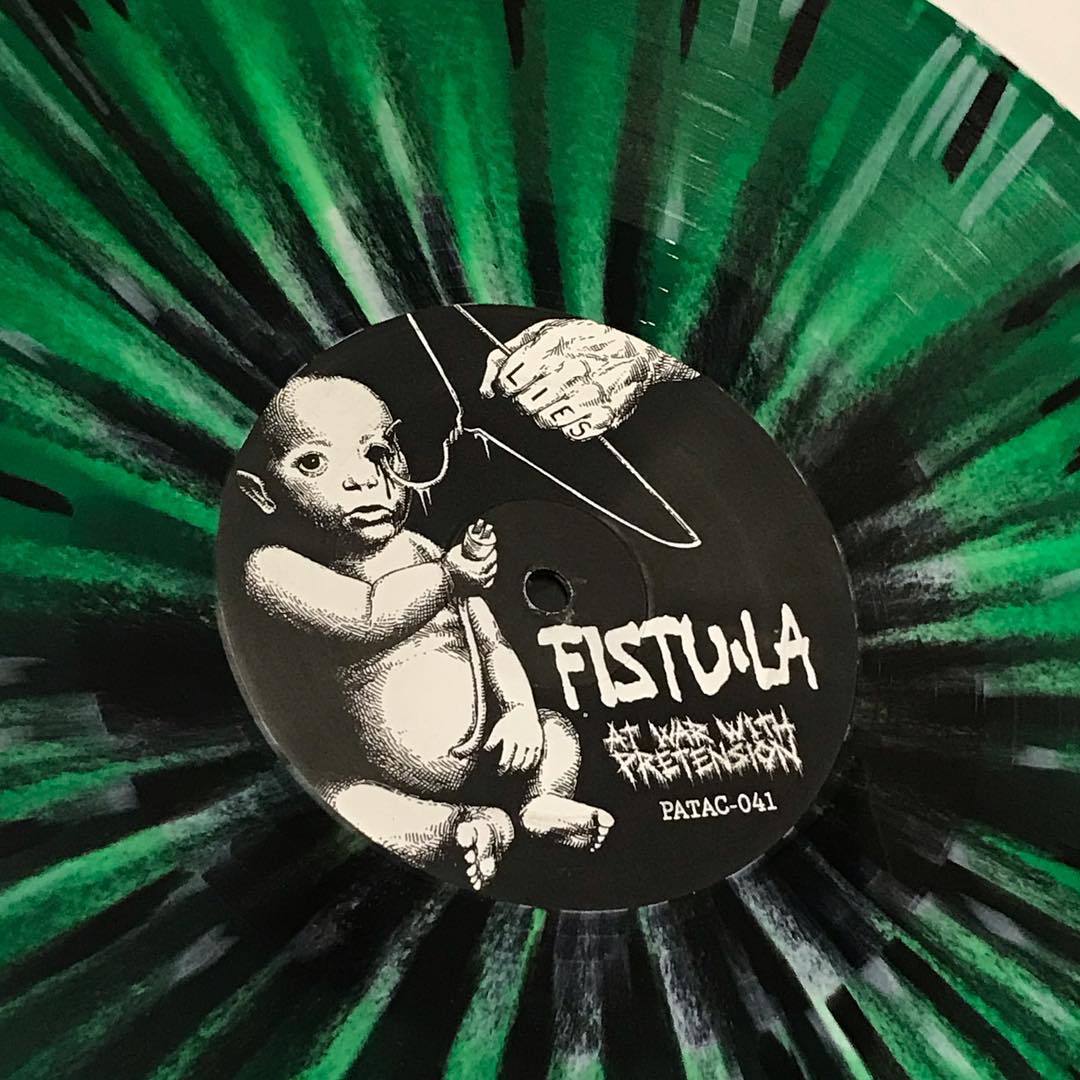 FISTULA: At War With Pretension LP (color vinyl)